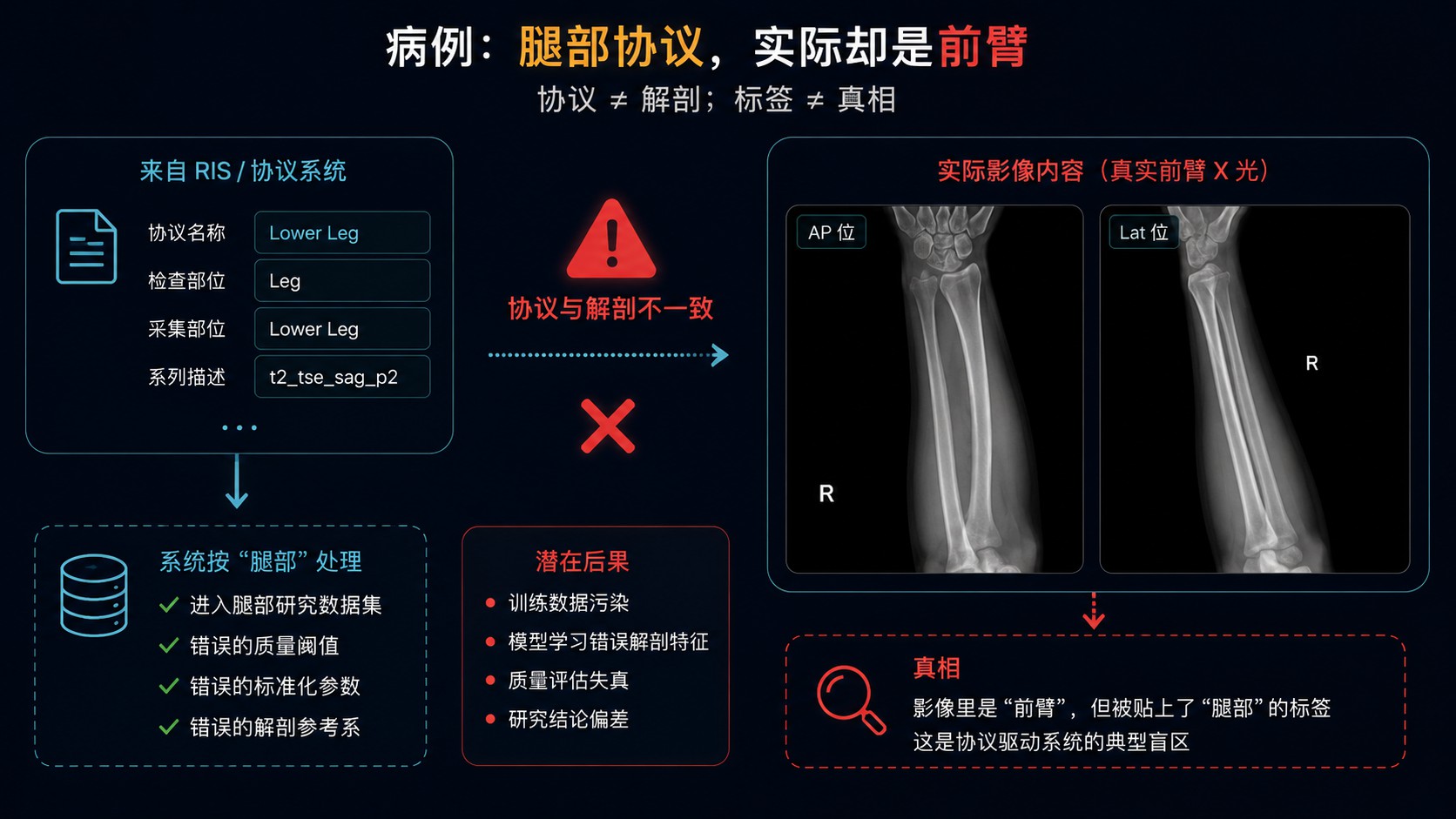 案例 06 配图：借用腿部协议扫描前臂的协议名误导示意